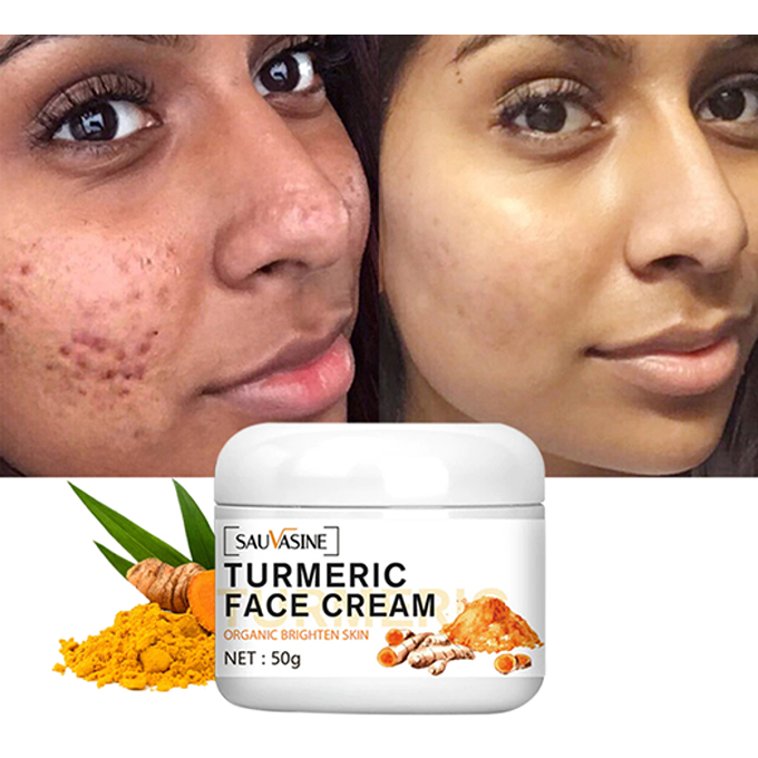 Turmeric Face Cream Acne Remover, Dark Spot Corrector, Anti-Aging, Face Brightening, Skin Moisturizing Repair Cream 50g